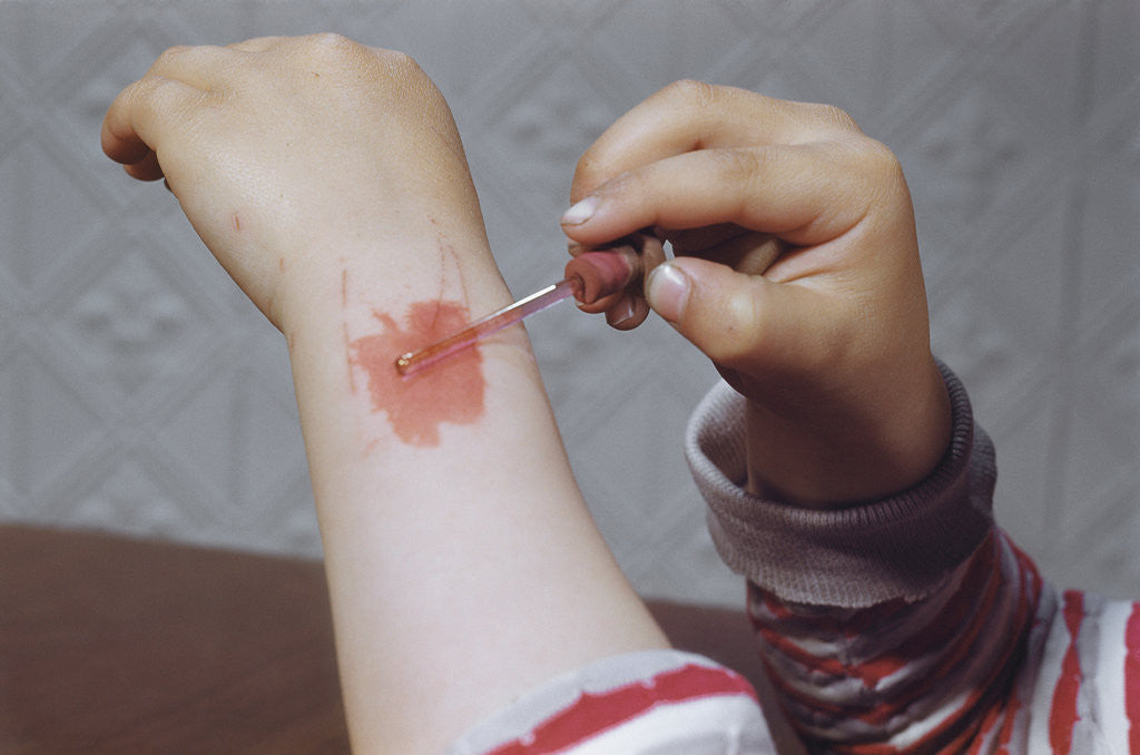 Detail of Placing Medicine on Infection by Anonymous