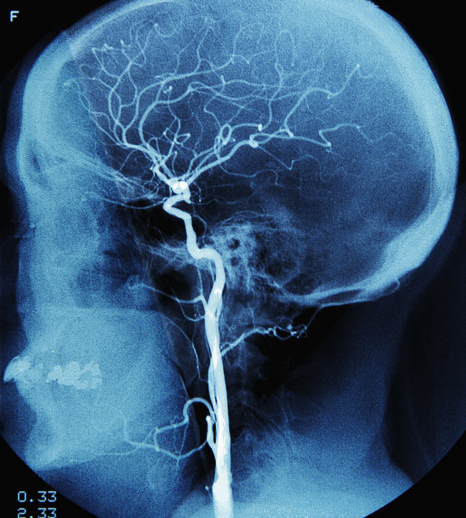 Detail of X-Ray of Human Head by Anonymous