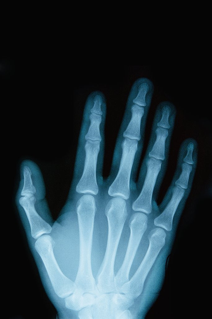 Detail of X-Ray of a Hand by Anonymous