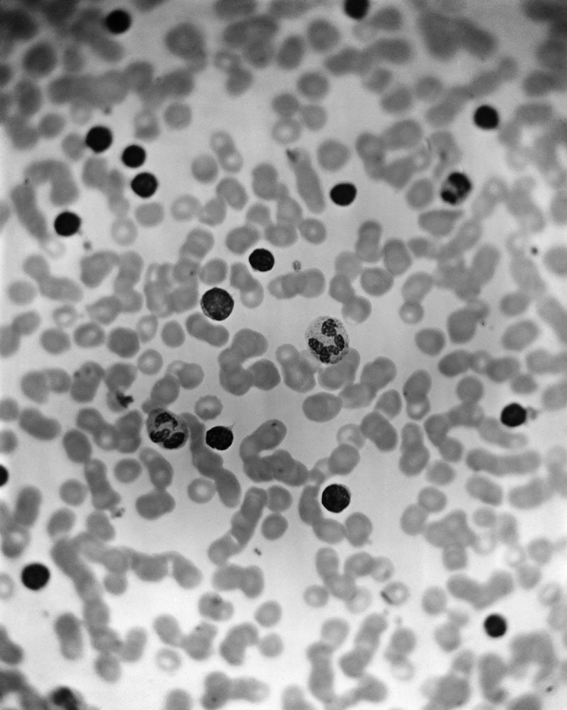 Detail of Microscopic View Of Human Blood by Anonymous