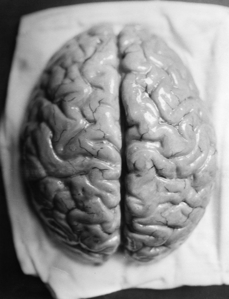Detail of The Human Brain by Corbis