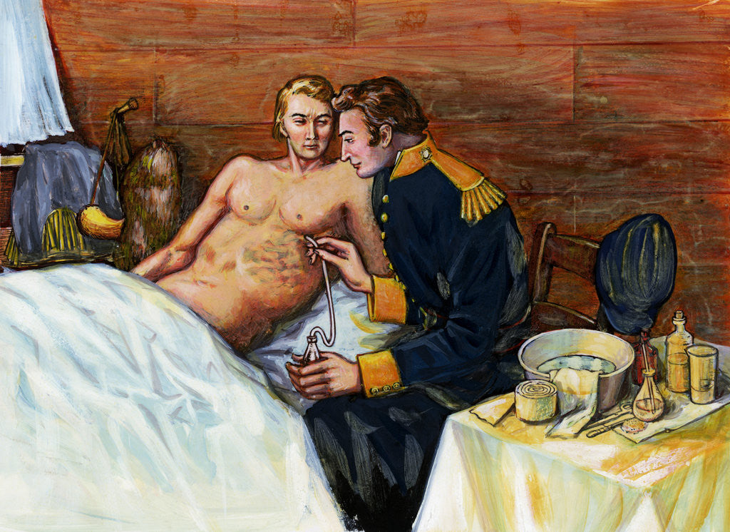Detail of Illustration of Dr. William Beaumont Inserting Tube In Alexis St. Martin's Torso by Anonymous