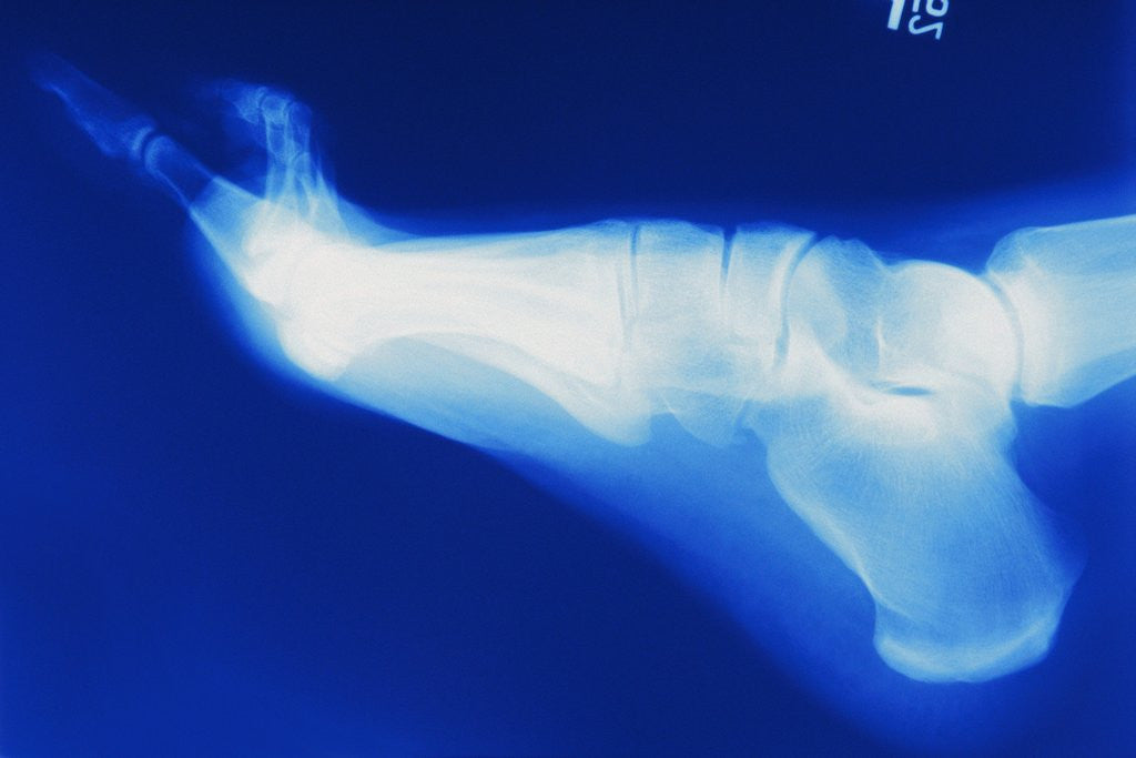 Detail of X-Ray of Person's Foot by Anonymous