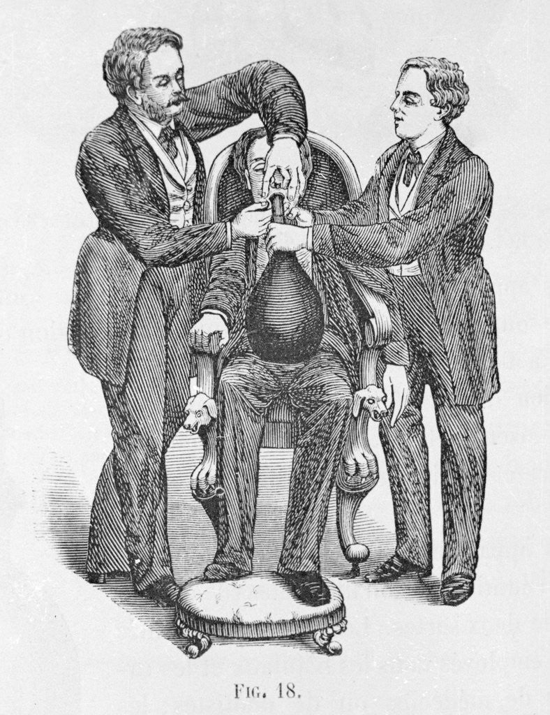 Detail of Early Anesthetic Procedure for Preparing Witness for Trial by Anonymous
