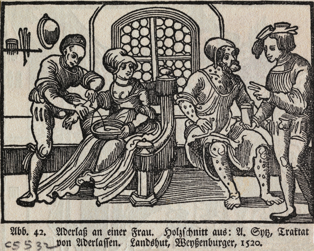 Detail of Bloodletting of Woman by Anonymous
