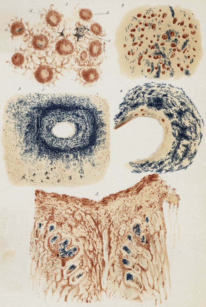 Detail of Illustration Depicting Infected Cells by Corbis