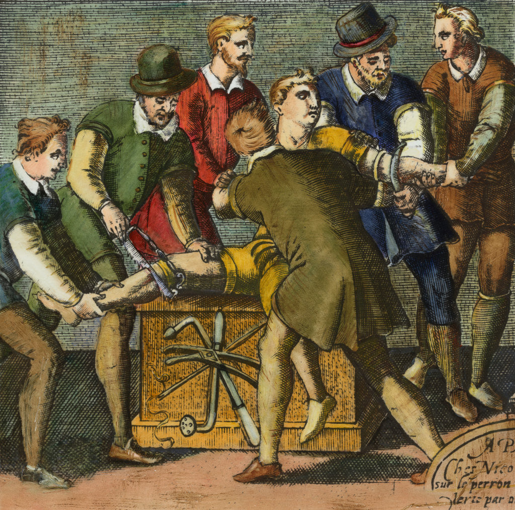 Detail of Physician and Assistants during Early History Leg Amputation by Anonymous