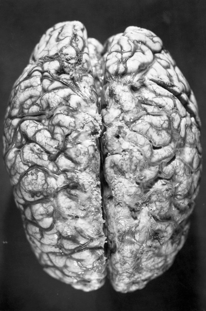 Detail of Top of Human Brain by Corbis