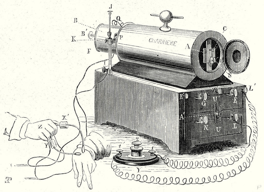 Detail of The Device of M. Duchenne (De Boulogne) by Anonymous