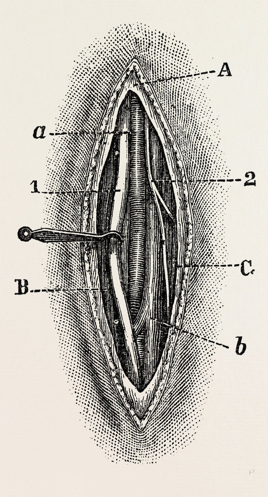 Detail of Ligature by Anonymous