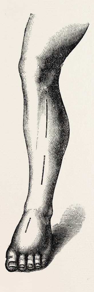 Detail of Ligature by Anonymous
