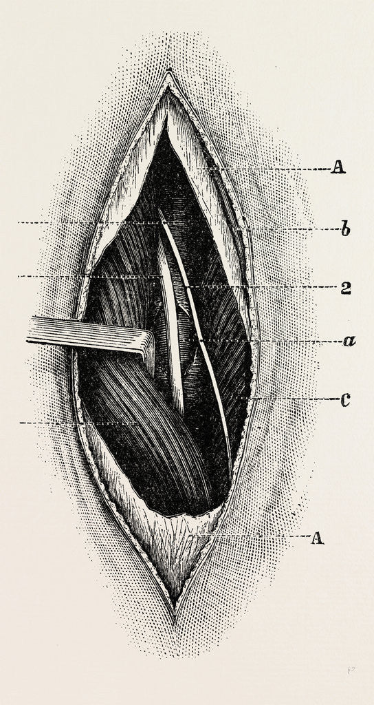 Detail of Ligature of by Anonymous