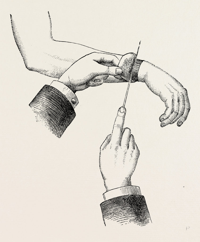 Detail of Circular amputation de la manchette by Anonymous