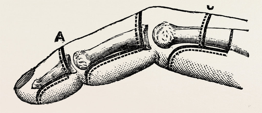Detail of Disarticulations by Anonymous