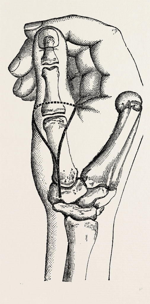 Detail of Disarticulation by Anonymous