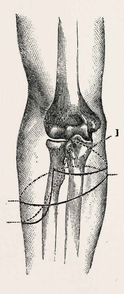 Detail of Disarticulation by Anonymous