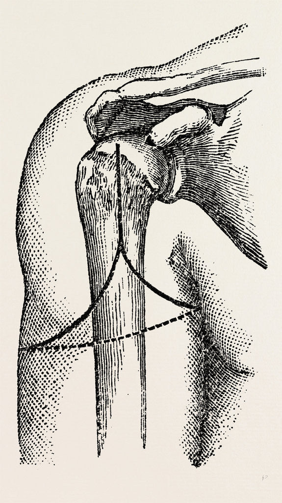 Detail of Disarticulation by Anonymous