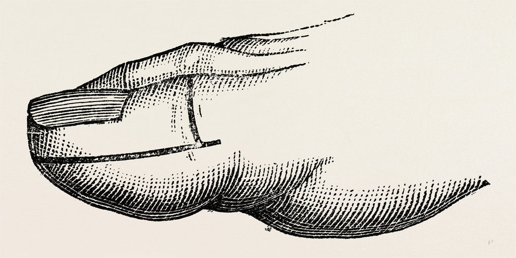 Detail of Disarticulation by Anonymous