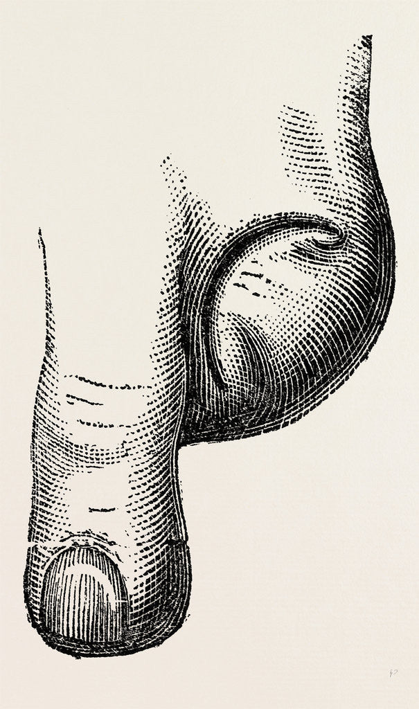 Detail of Disarticulation by Anonymous