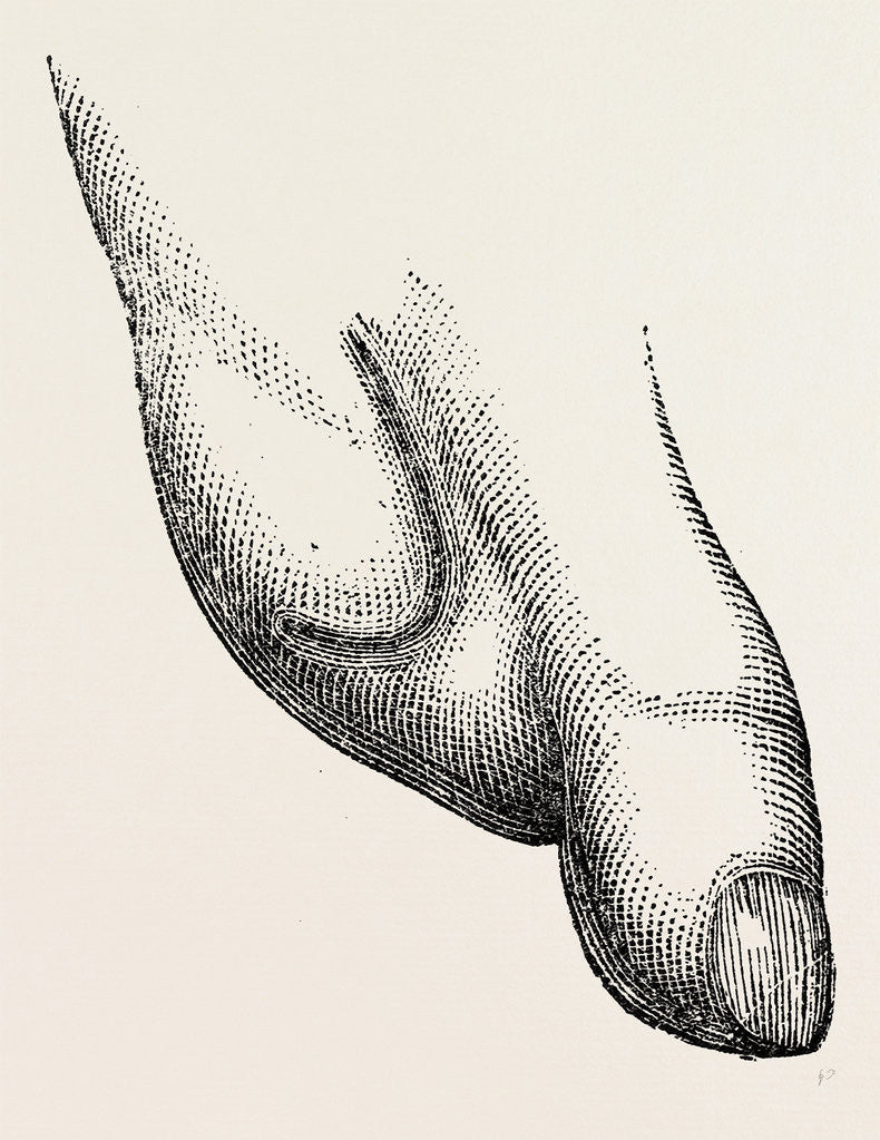 Detail of Disarticulation the operator by Anonymous