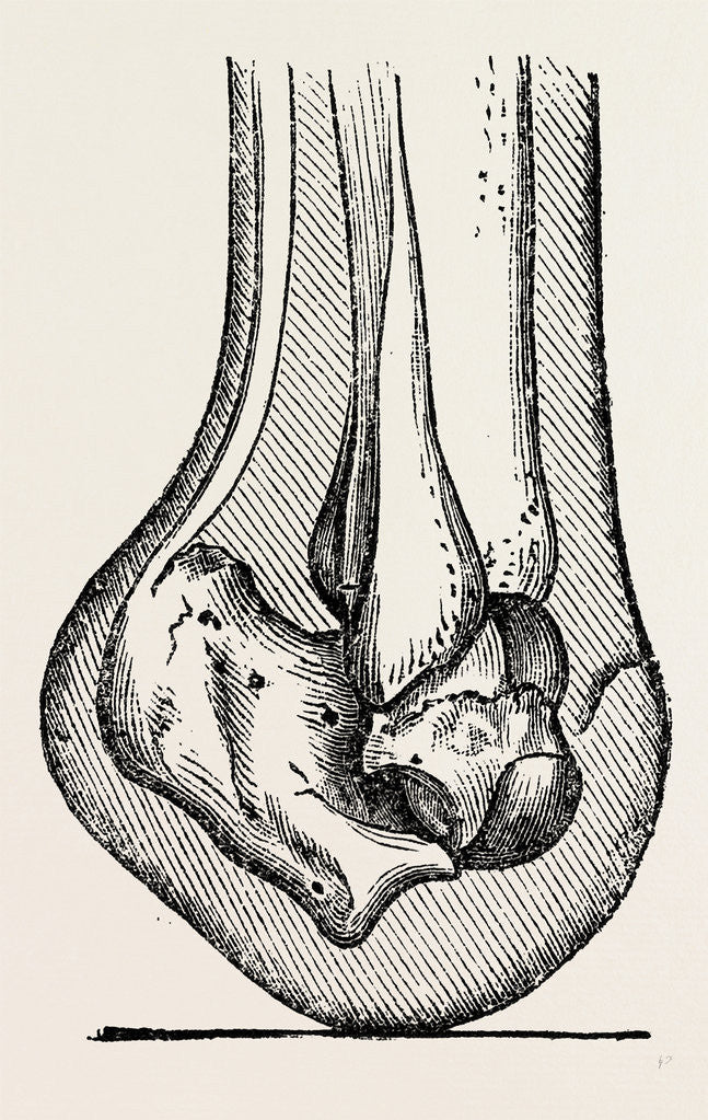Detail of Anatomy by Anonymous