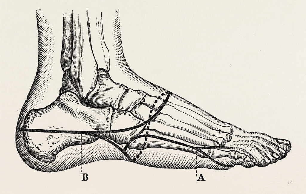 Detail of Disarticulation of the little toe by Anonymous