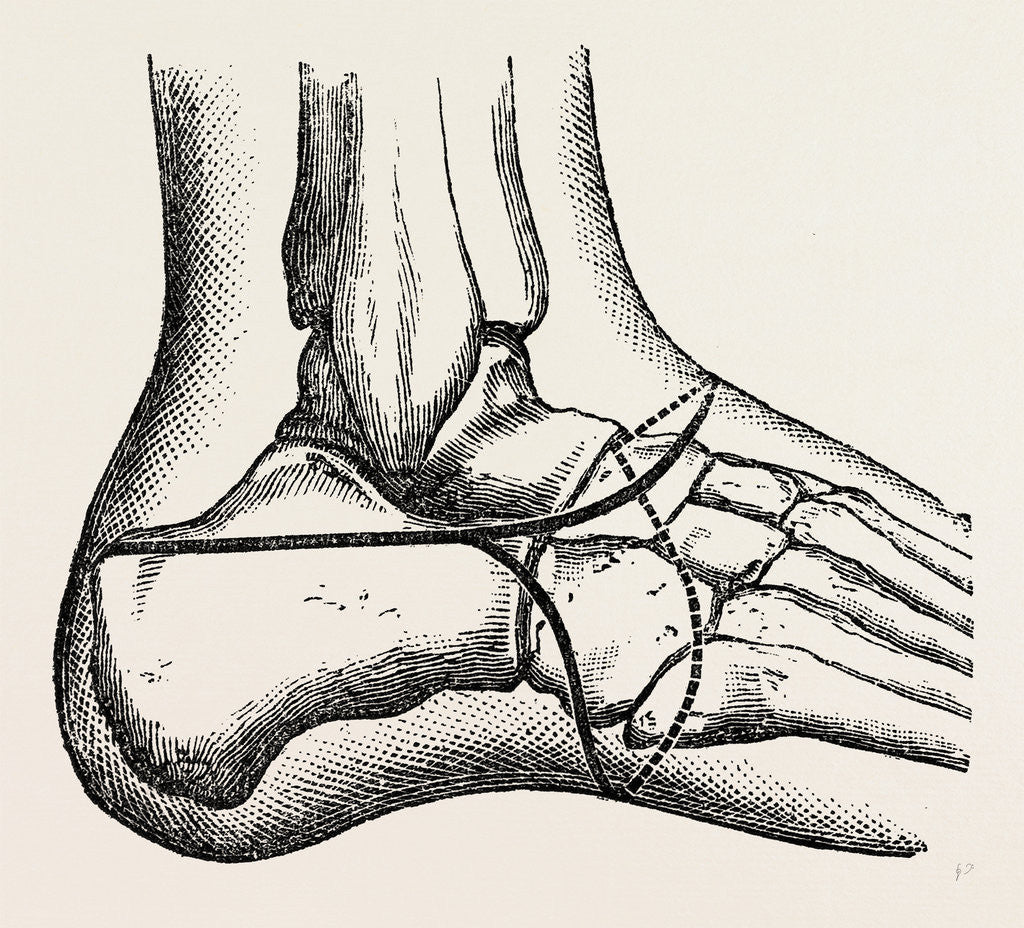 Detail of Pasquier by Anonymous