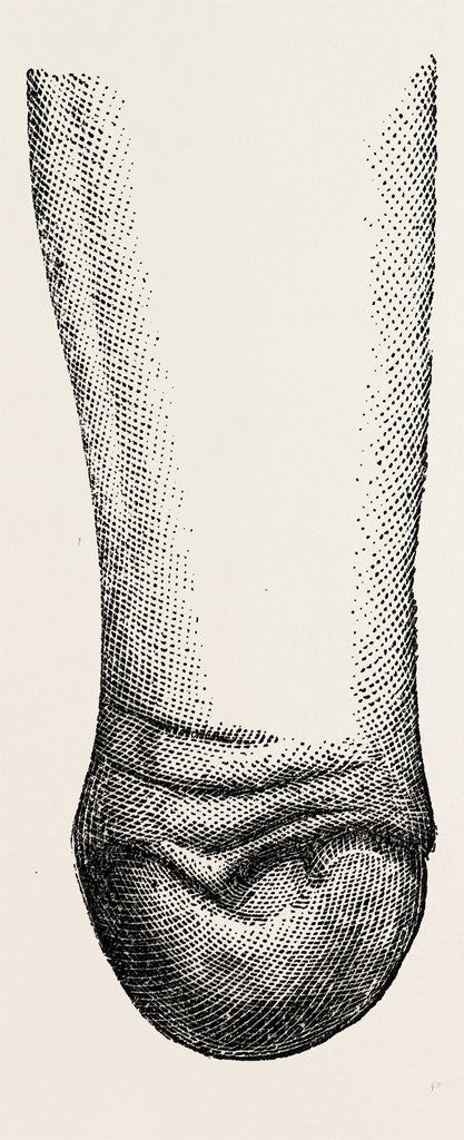 Detail of Stump by Anonymous