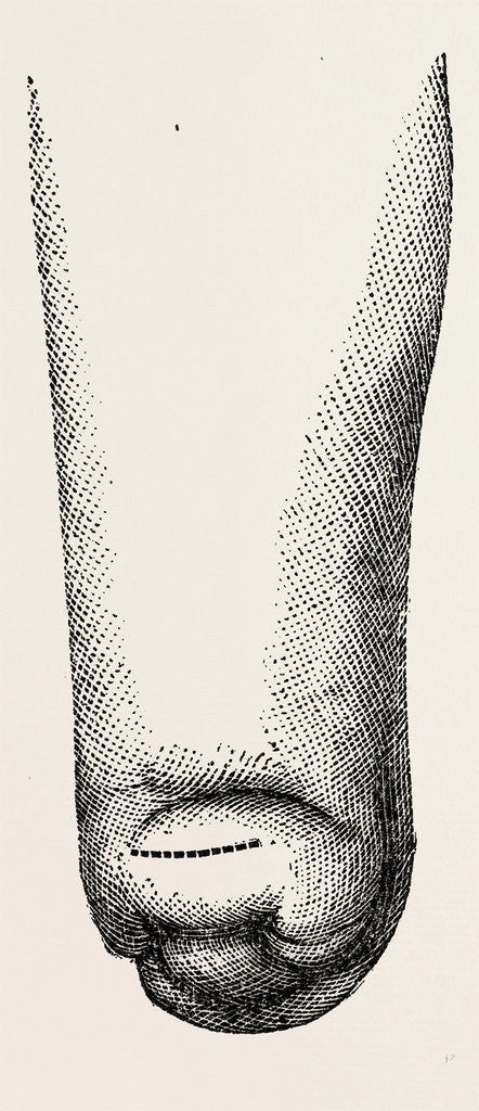 Detail of Stump by Anonymous