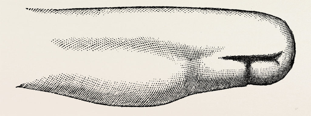 Detail of Stump left after by Anonymous