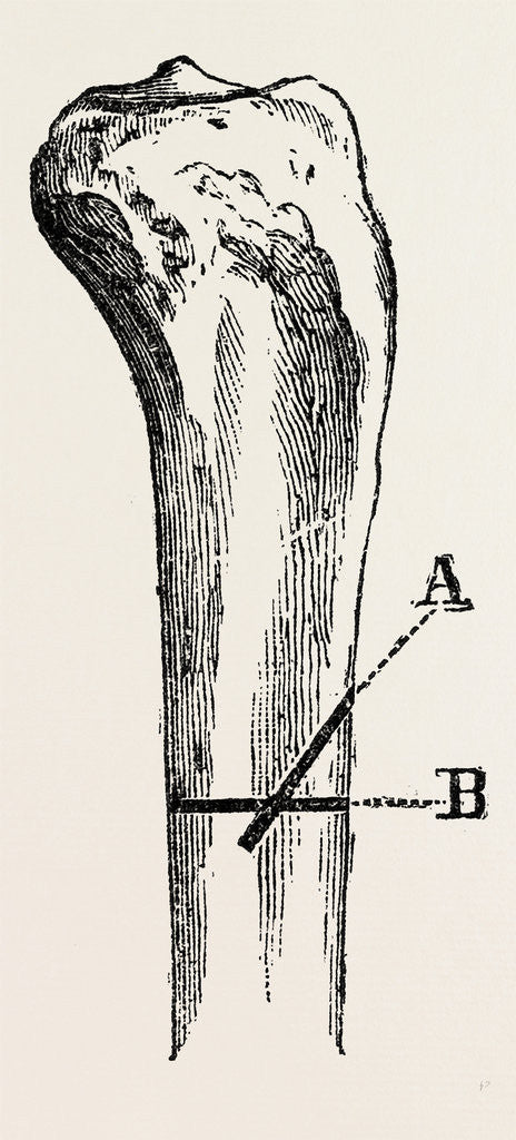 Detail of Method of method of sawing by Anonymous