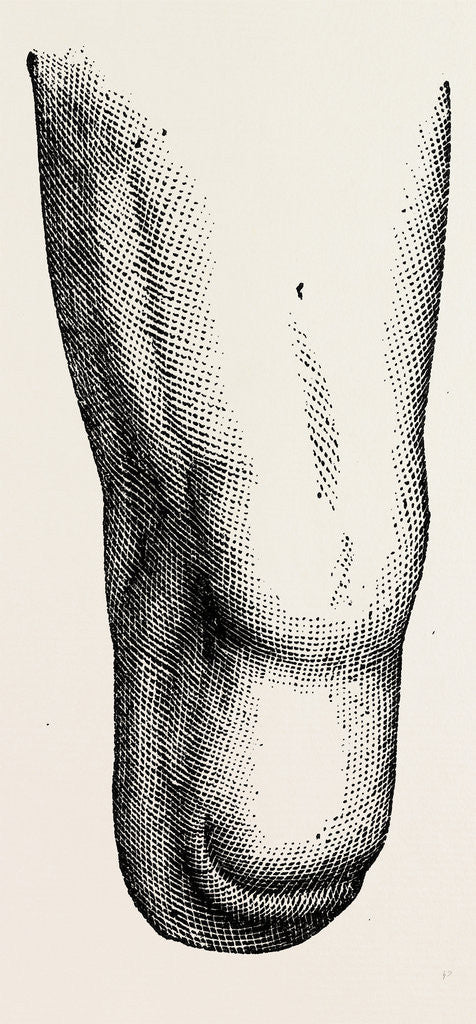 Detail of Stump by Anonymous