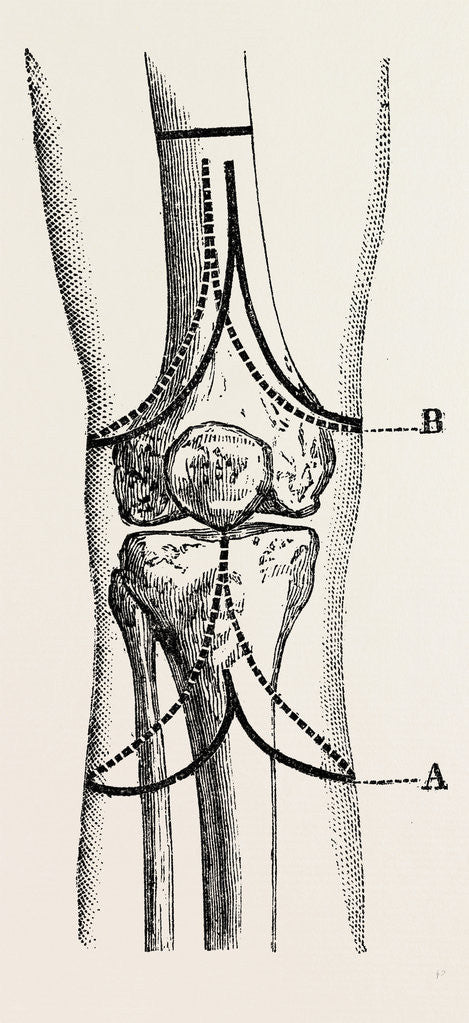Detail of Stephen smith's by Anonymous