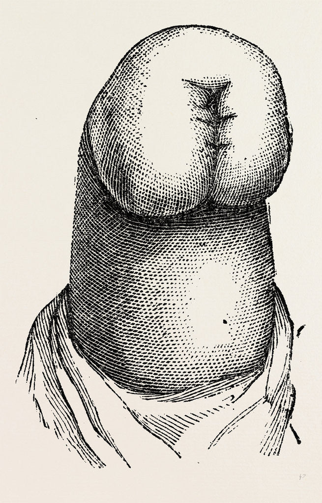 Detail of The stump by Anonymous