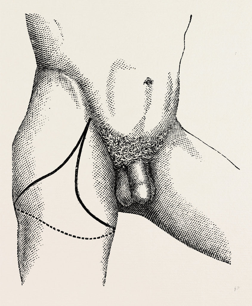 Detail of Disarticulation by Anonymous