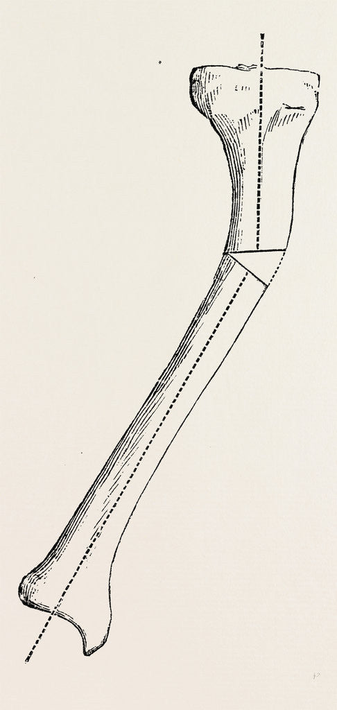 Detail of Bone by Anonymous