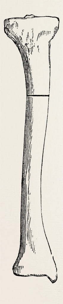 Detail of Bone by Anonymous