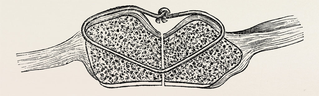 Detail of Fragments in apposition, the wire knot hammered flat by Anonymous