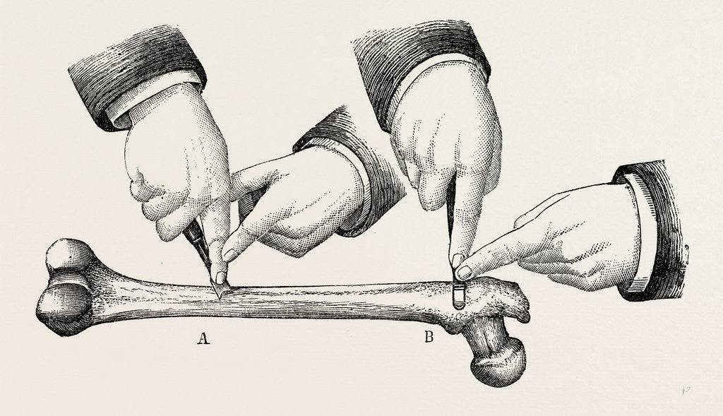 Detail of The method of using the rugine by Anonymous