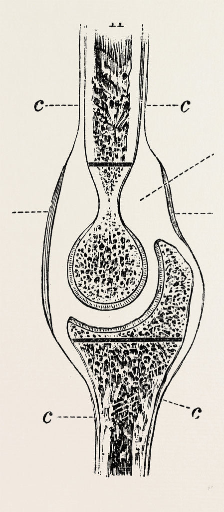 Detail of Diagrams to illustrate the sub-periosteal method of resection by Anonymous