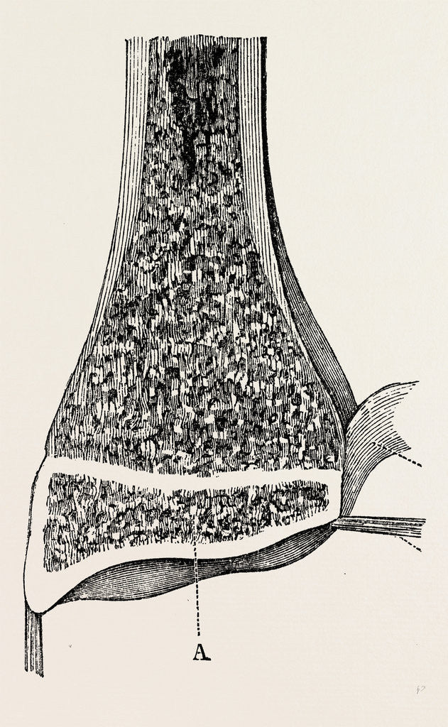 Detail of Radio-car lower end of the radius by Anonymous