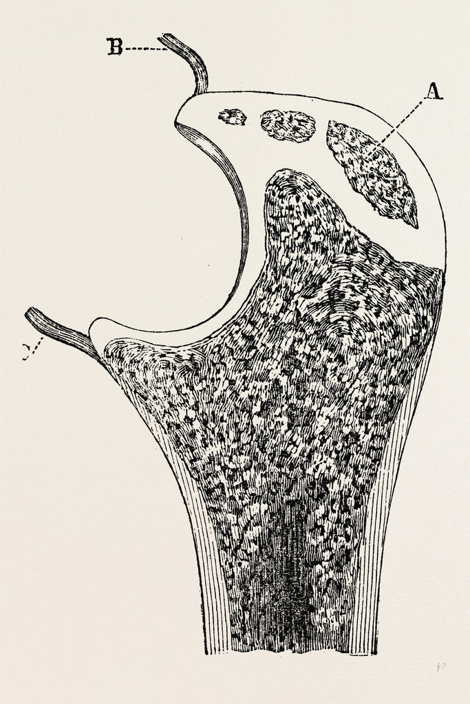 Detail of End of the ulna by Anonymous