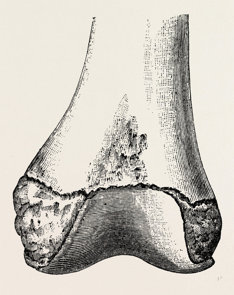 Detail of Epiphyses of the femur by Anonymous