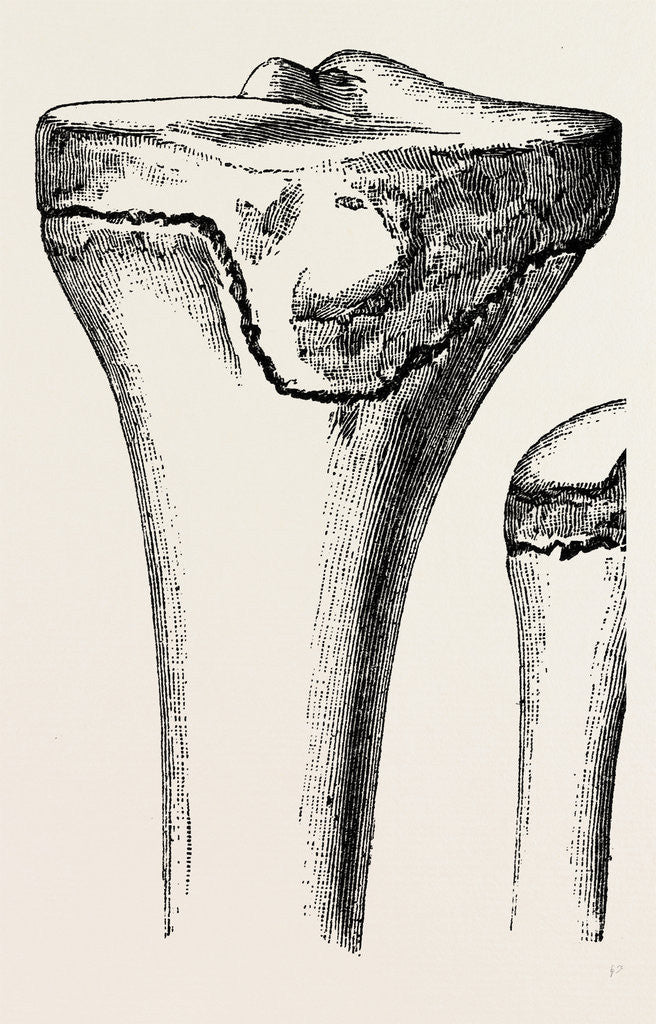 Detail of Epiphyses of the femur by Anonymous