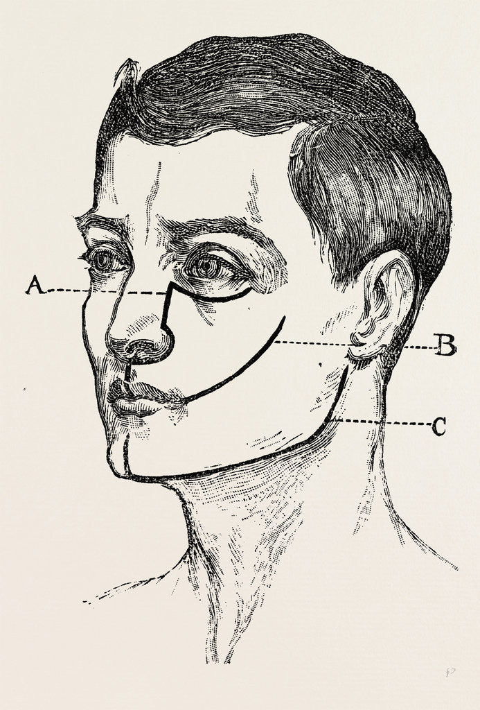 Detail of Excision by Anonymous