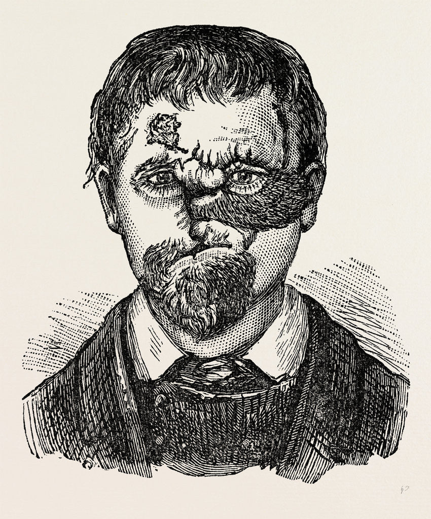 Detail of Aspect of patient by Anonymous