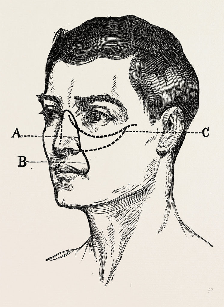 Detail of Operations for naso-pharyngral by Anonymous
