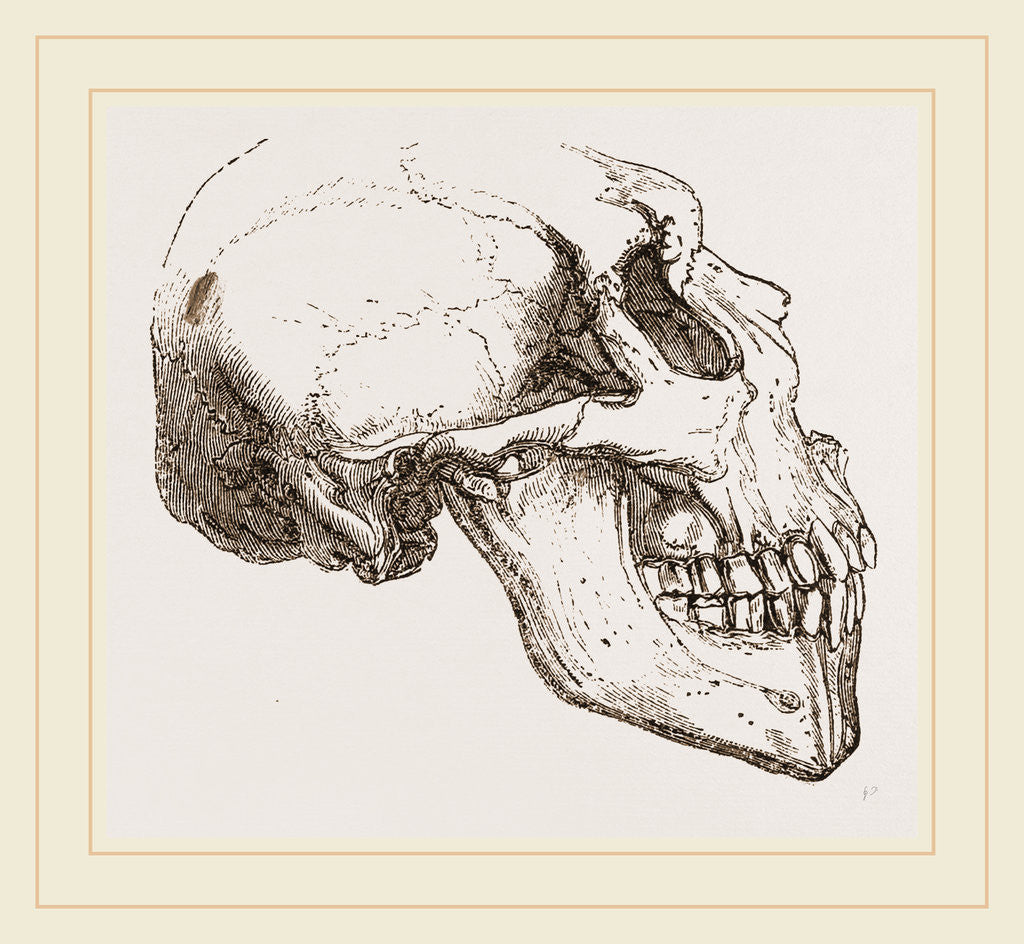 Detail of Skull of Human Idiot by Anonymous