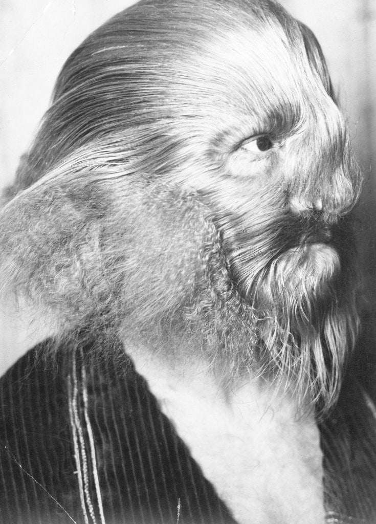 Detail of Portrait of a Genetically Hairy Man by Anonymous