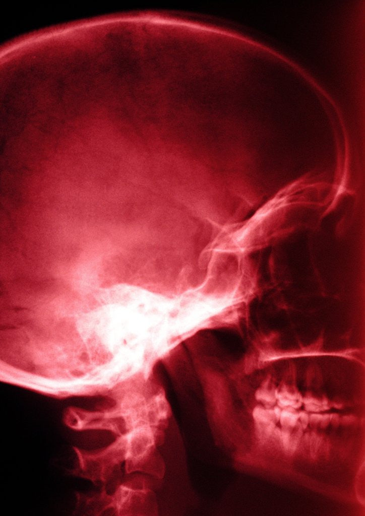 Detail of X-Ray of Human Skull by Corbis